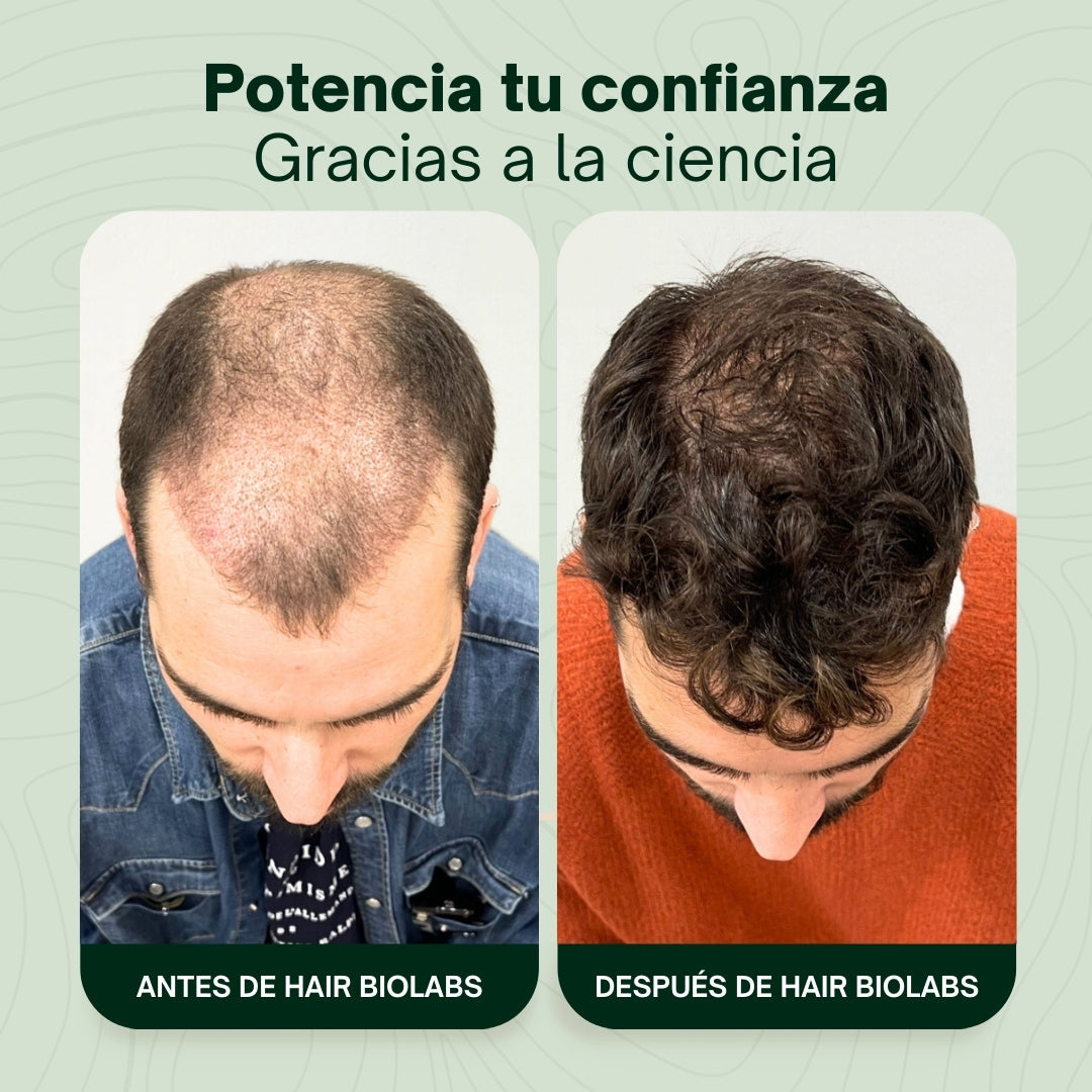 Serum Anticaída