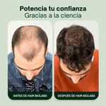 Serum Anticaída