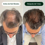 Serum Anticaída