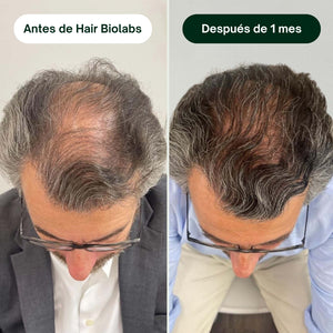 Serum Anticaída