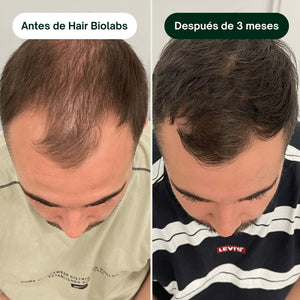 Serum Anticaída
